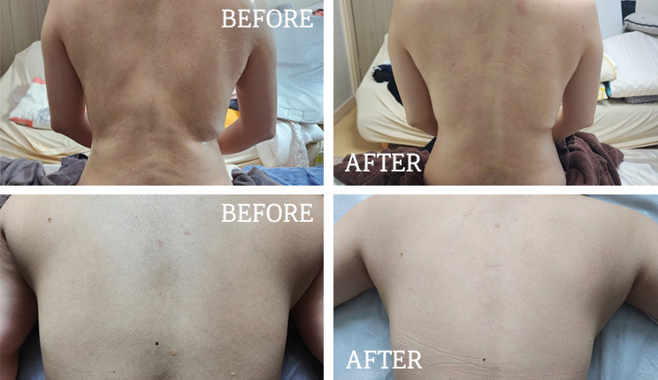 BEFORE</br>AND</br>AFTER