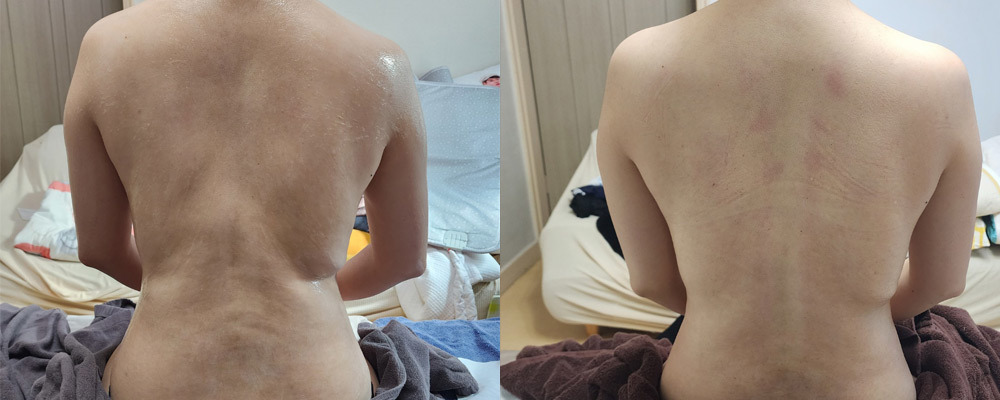 BEFORE AND AFTER