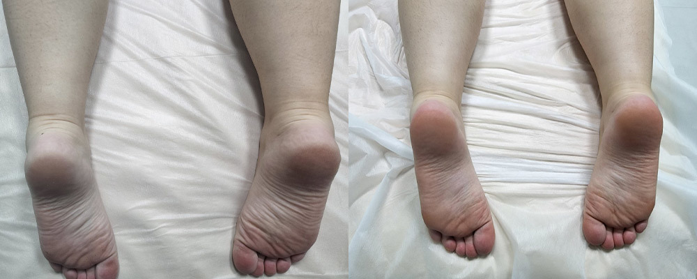 BEFORE AND AFTER