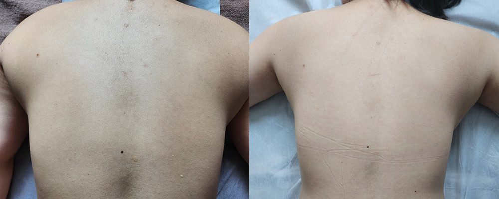 BEFORE AND AFTER